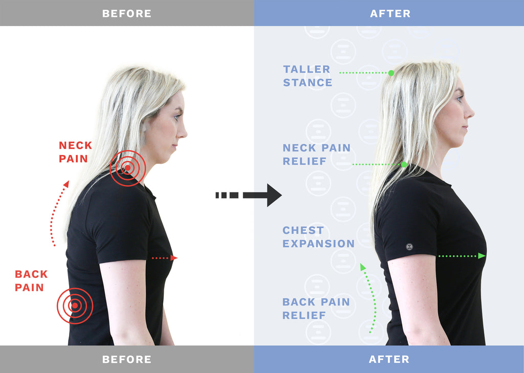 7 Easy Exercises to Improve Poor Posture